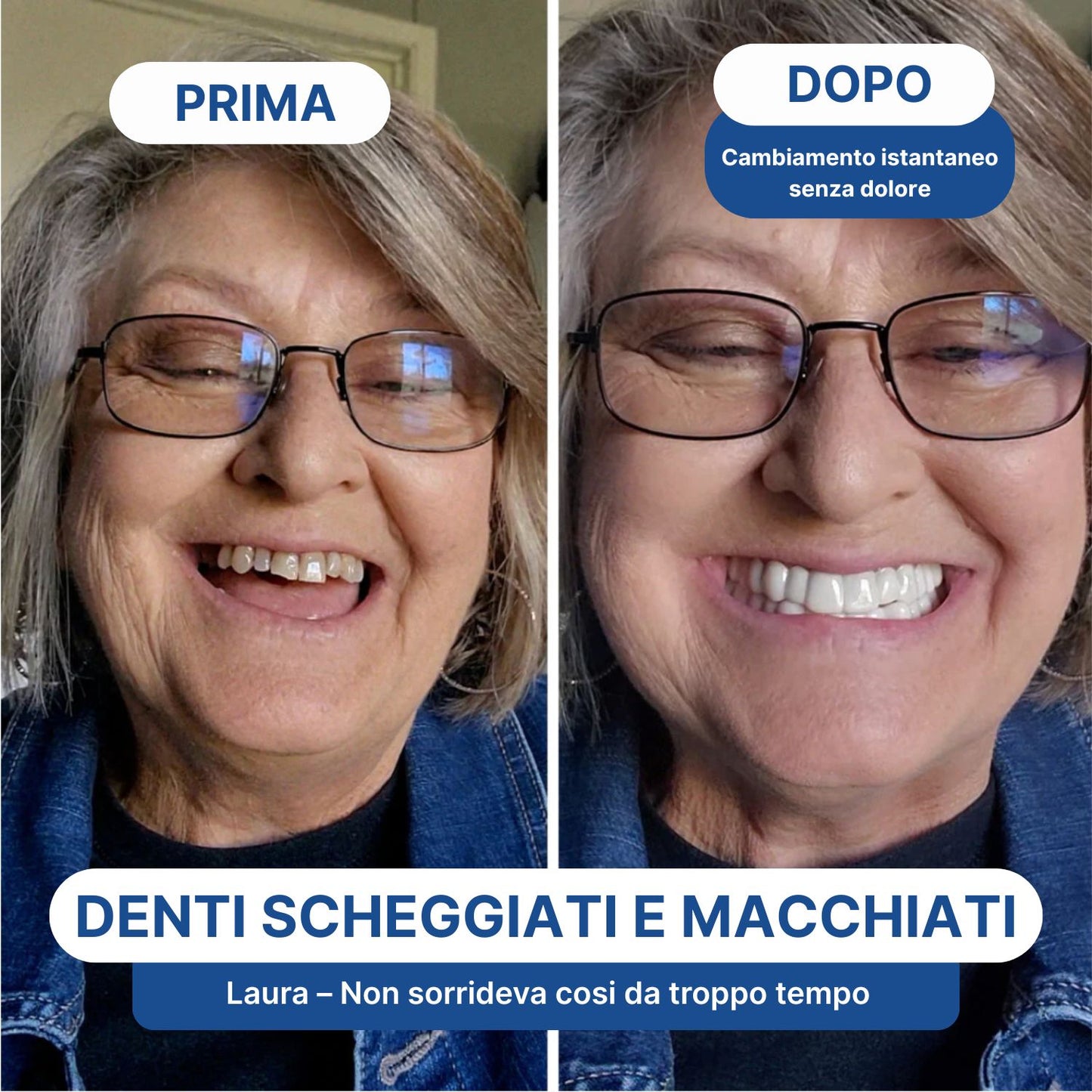 Faccette Dentali Personalizzate – Il Sorriso Che Hai Sempre Desiderato
