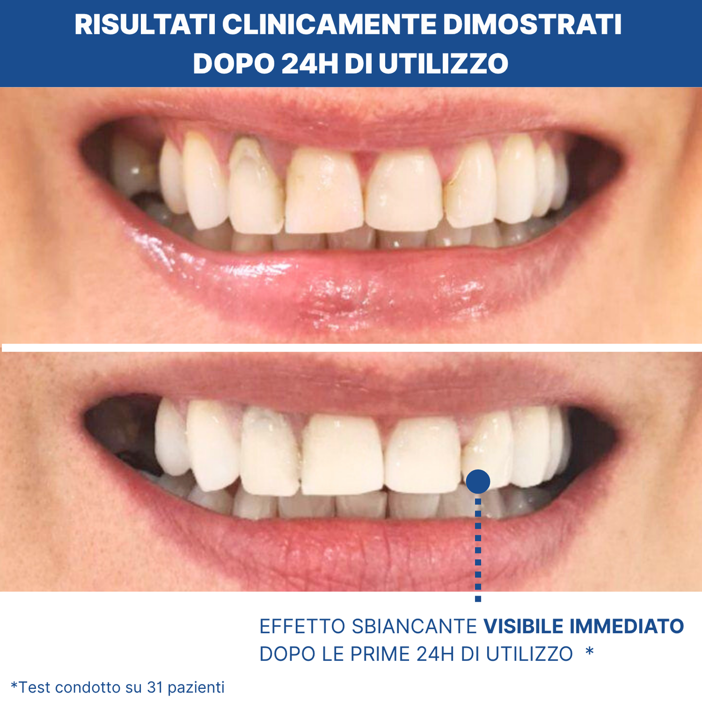 Dentifricio Viola Sbiancante