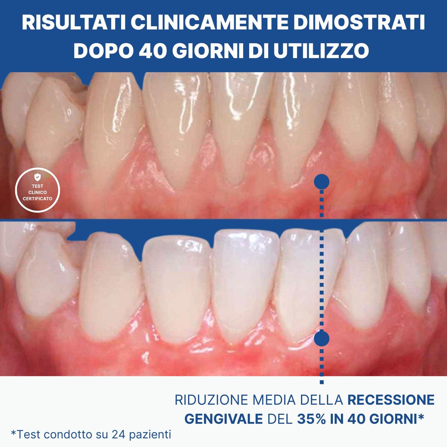 ParallelClean+ | Spazzolino Automatico Con Effetto Sbiancante
