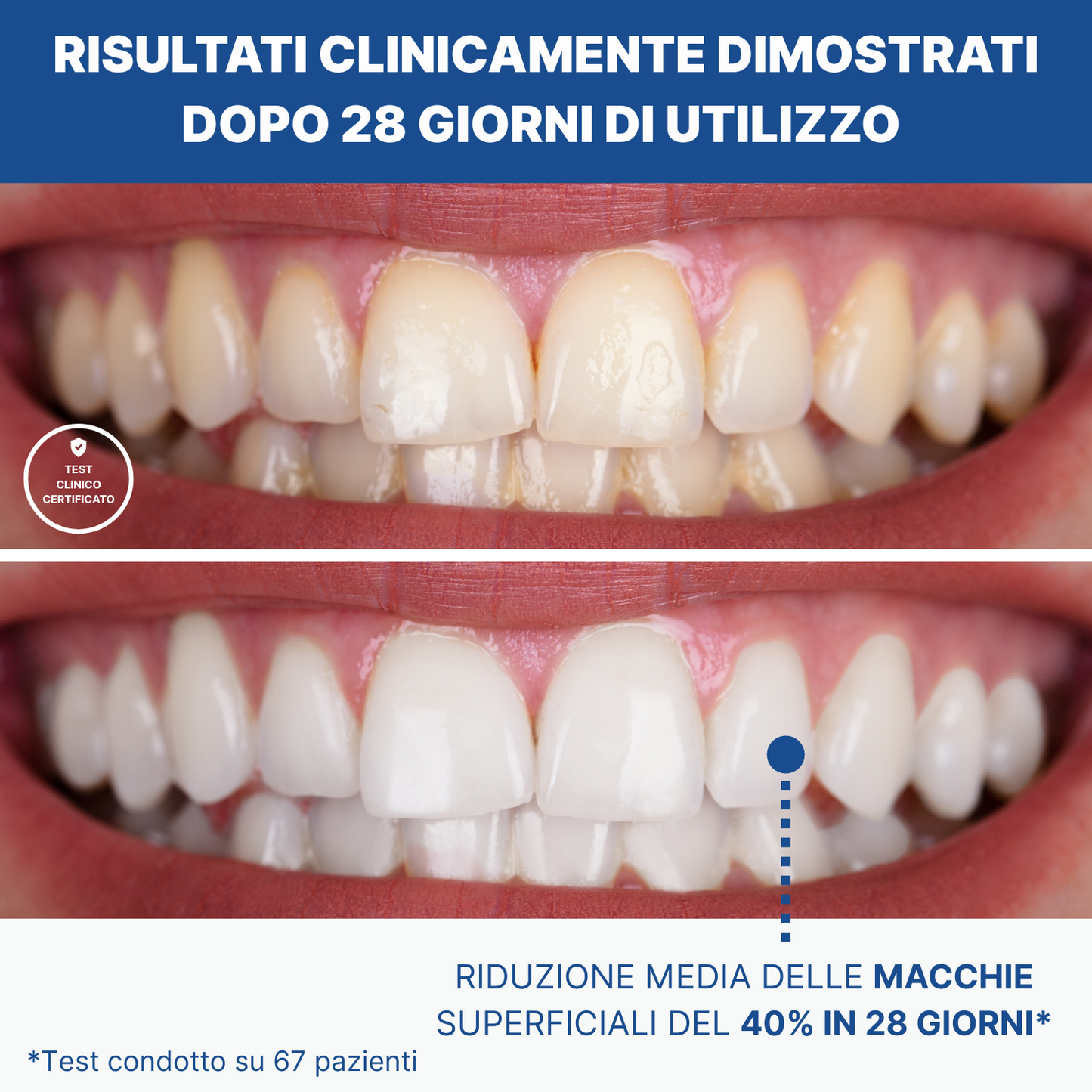 ParallelClean+ | Spazzolino Automatico Con Effetto Sbiancante
