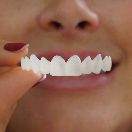 FACCETTE DENTALI A 299€ VS 15.000€
