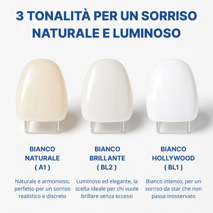 Faccette Dentali Personalizzate – Il Sorriso Che Hai Sempre Desiderato