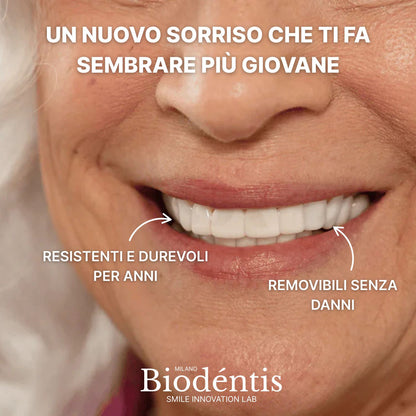 Faccette Dentali Personalizzate – Il Sorriso Che Hai Sempre Desiderato