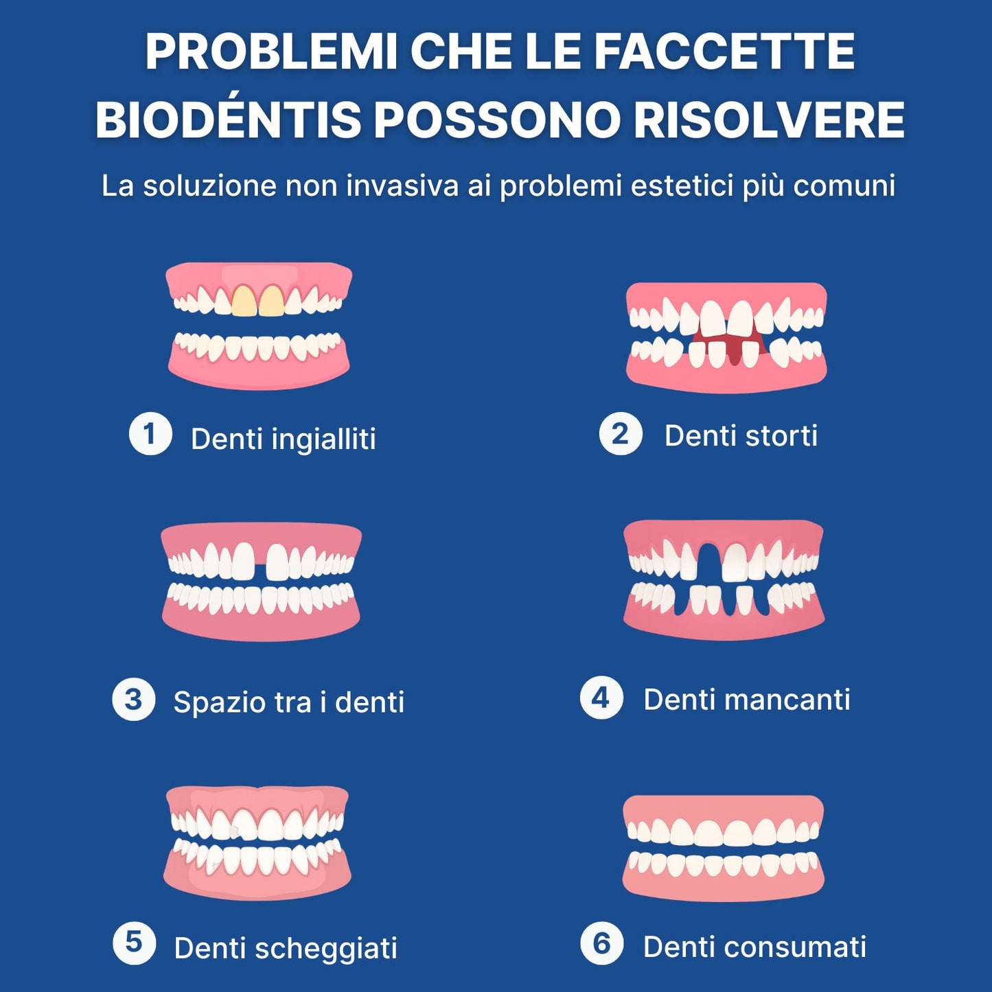 Faccette Dentali Personalizzate – Il Sorriso Che Hai Sempre Desiderato