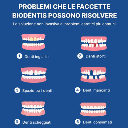 Faccette Dentali Personalizzate – Il Sorriso Che Hai Sempre Desiderato
