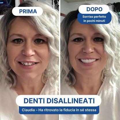 Faccette Dentali Personalizzate – Il Sorriso Che Hai Sempre Desiderato